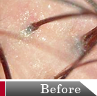 �w�b�h�X�p������f�g�b�N�X�P�A�@Before